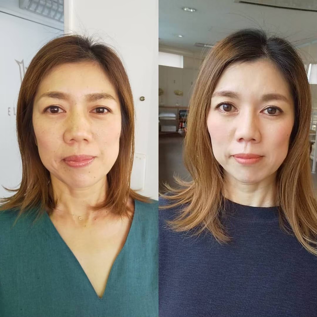 beforeafter10