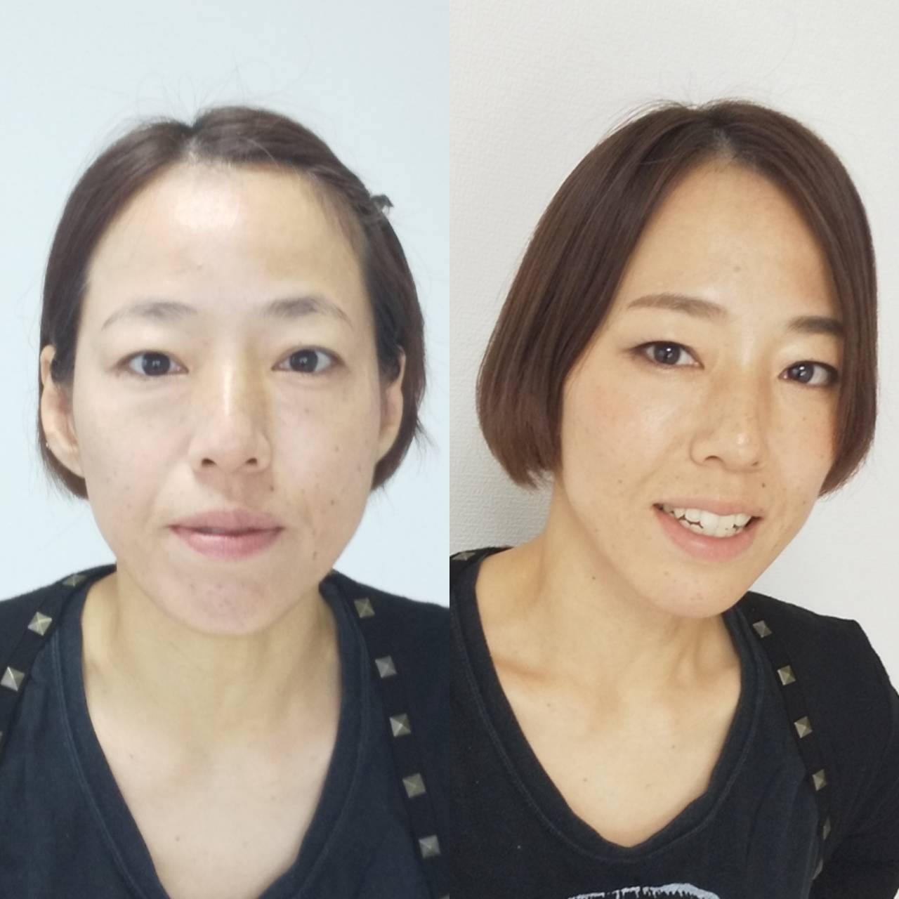 beforeafter32